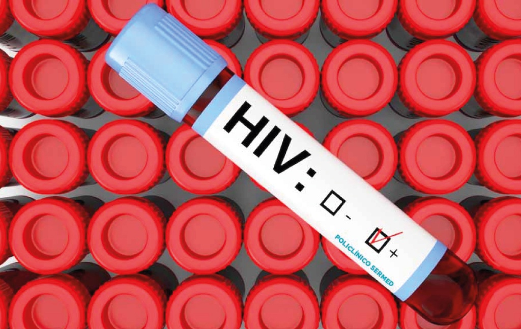 Hiv tipo 1 / 2